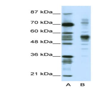 anti-Coronin, Actin Binding Protein, 1A (CORO1A) (C-Term) antibody avatar
