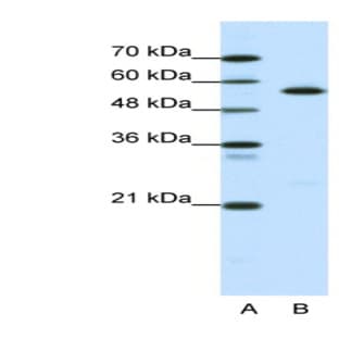 anti-Coronin, Actin Binding Protein, 1A (CORO1A) (Middle Region) antibody avatar