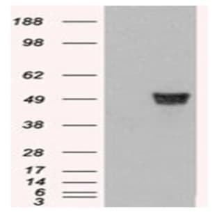 anti-Coronin, Actin Binding Protein, 1A (CORO1A) (C-Term) antibody avatar