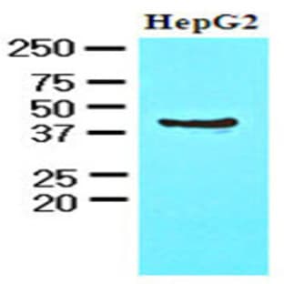 anti-Chitinase 3-Like 1 (Cartilage Glycoprotein-39) (CHI3L1) (AA 22-383) antibody avatar