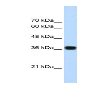 anti-PC4 and SFRS1 Interacting Protein 1 (PSIP1) (N-Term) antibody avatar
