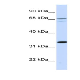 anti-PC4 and SFRS1 Interacting Protein 1 (PSIP1) (Middle Region) antibody avatar