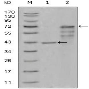 anti-Chitinase 1 (AA 22-137) antibody avatar