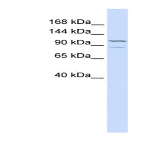 anti-Adenylate Cyclase 6 (ADCY6) (C-Term) antibody avatar