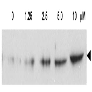 anti-Checkpoint Kinase 2 (CHEK2) (AA 64-73), (pThr68) antibody avatar