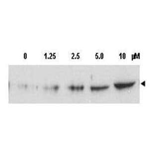 anti-Checkpoint Kinase 2 (CHEK2) (AA 64-73), (pThr68) antibody avatar
