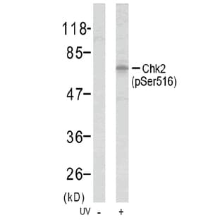 anti-Checkpoint Kinase 2 (CHEK2) (pSer516) antibody avatar