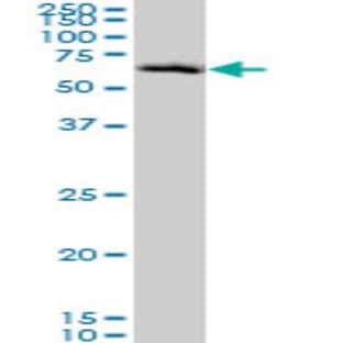anti-Checkpoint Kinase 2 (CHEK2) (AA 1-544) antibody avatar