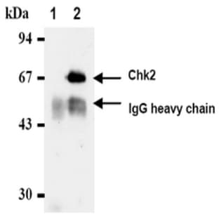 anti-Checkpoint Kinase 2 (CHEK2) antibody avatar