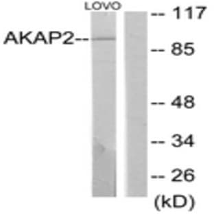 anti-A Kinase (PRKA) Anchor Protein 2 (AKAP2) antibody avatar