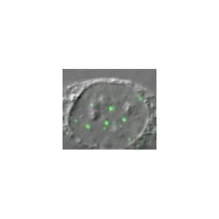 anti-DEAD (Asp-Glu-Ala-Asp) Box Polypeptide 20 (DDX20) (AA 368-548) antibody avatar
