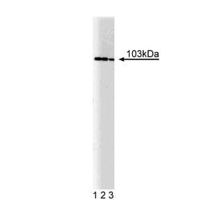 anti-DEAD (Asp-Glu-Ala-Asp) Box Polypeptide 20 (DDX20) (AA 667-783) antibody avatar