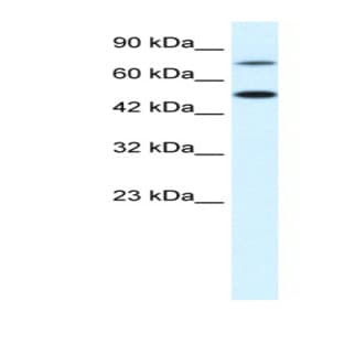anti-Choroideremia-Like (Rab Escort Protein 2) (CHML) (N-Term) antibody avatar