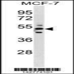 anti-Chimerin 1 (CHN1) (N-Term), (AA 1-30) antibody avatar