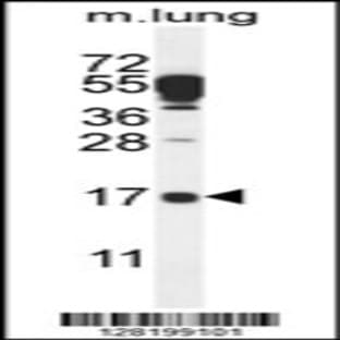anti-Chromosome 14 Open Reading Frame 126 (C14orf126) (C-Term), (AA 136-164) antibody avatar