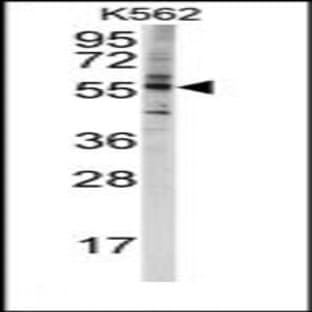 anti-Cytochrome P450, Family 4, Subfamily F, Polypeptide 8 (CYP4F8) (C-Term) antibody avatar