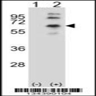 anti-Cholinergic Receptor, Muscarinic 2 (CHRM2) (AA 336-364), (Center) antibody avatar