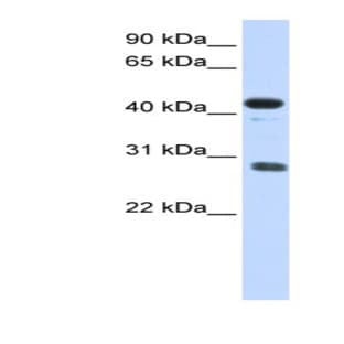 anti-Cell Division Cycle Associated 5 (CDCA5) (Middle Region) antibody avatar