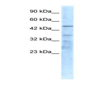 anti-Cholinergic Receptor, Nicotinic, alpha 1 (Muscle) (CHRNA1) (N-Term) antibody avatar
