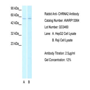 anti-Cholinergic Receptor, Nicotinic, alpha 2 (Neuronal) (CHRNA2) (N-Term) antibody avatar