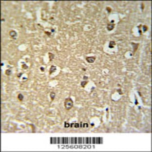 anti-Cholinergic Receptor, Nicotinic, alpha 3 (Neuronal) (CHRNA3) (N-Term), (AA 25-52) antibody avatar