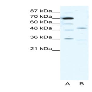anti-Cholinergic Receptor, Nicotinic, alpha 3 (Neuronal) (CHRNA3) (N-Term) antibody avatar