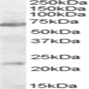 anti-Cholinergic Receptor, Nicotinic, alpha 4 (CHRNA4) (Internal Region) antibody avatar