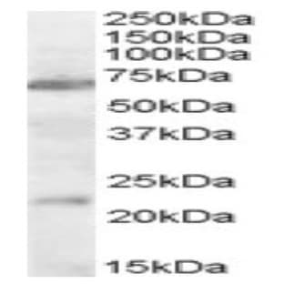 anti-Cholinergic Receptor, Nicotinic, alpha 4 (CHRNA4) (Internal Region), (AA 29-43) antibody avatar
