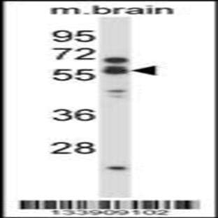 anti-Cholinergic Receptor, Nicotinic, alpha 5 (Neuronal) (CHRNA5) (AA 187-216), (Center) antibody avatar