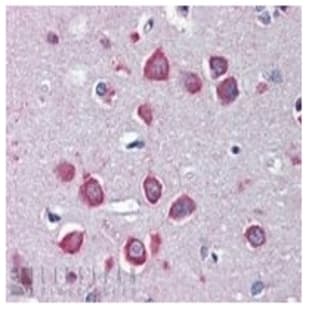 anti-Cholinergic Receptor, Nicotinic, alpha 7 (Neuronal) (CHRNA7) (Internal Region) antibody avatar