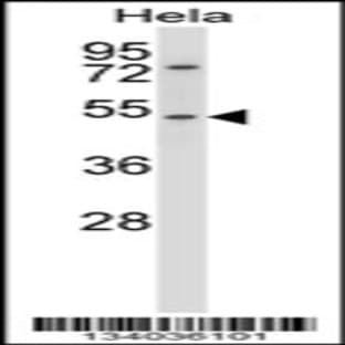 anti-Cholinergic Receptor, Nicotinic, alpha 7 (Neuronal) (CHRNA7) (N-Term), (AA 8-37) antibody avatar