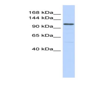anti-Adenylate Cyclase 8 (Brain) (ADCY8) (Middle Region) antibody avatar