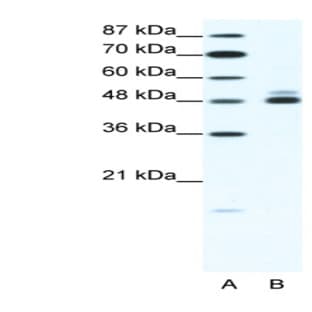 anti-Cholinergic Receptor, Nicotinic, beta 2 (Neuronal) (CHRNB2) (N-Term) antibody avatar
