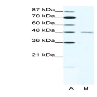 anti-Cholinergic Receptor, Nicotinic, delta (Muscle) (CHRND) (N-Term) antibody avatar