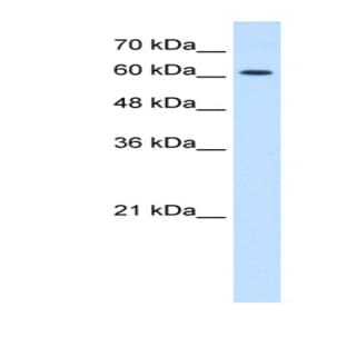 anti-Cholinergic Receptor, Nicotinic, epsilon (Muscle) (CHRNE) (N-Term) antibody avatar