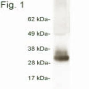 anti-Adiponectin, C1Q and Collagen Domain Containing (ADIPOQ) (AA 18-32), (AA 187-200) antibody avatar
