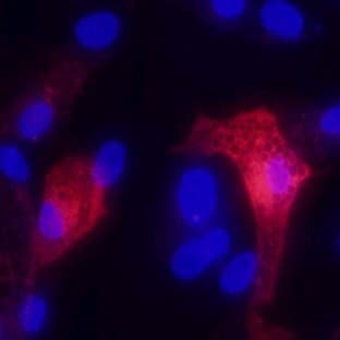 anti-Adiponectin, C1Q and Collagen Domain Containing (ADIPOQ) antibody avatar