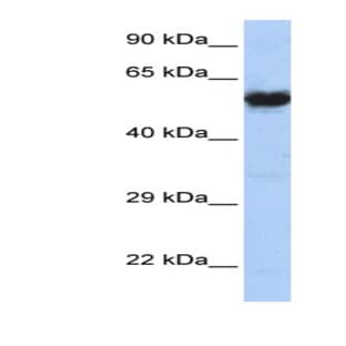 anti-Cholinergic Receptor, Nicotinic, gamma Polypeptide (CHRNG) (N-Term) antibody avatar