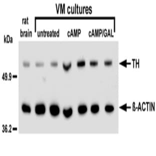 anti-Actin, beta (ACTB) (AA 1-14) antibody avatar