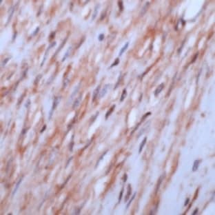 anti-Actin, beta (ACTB) (AA 26-33) antibody avatar