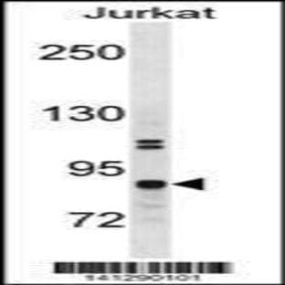 anti-conserved Helix-Loop-Helix Ubiquitous Kinase (CHUK) (N-Term), (AA 84-112) antibody avatar