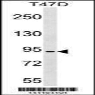 anti-conserved Helix-Loop-Helix Ubiquitous Kinase (CHUK) (C-Term), (AA 553-582) antibody avatar