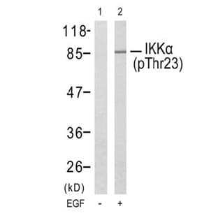 anti-conserved Helix-Loop-Helix Ubiquitous Kinase (CHUK) (pThr23) antibody avatar