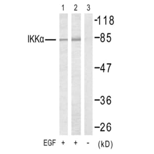 anti-conserved Helix-Loop-Helix Ubiquitous Kinase (CHUK) (Thr23) antibody avatar