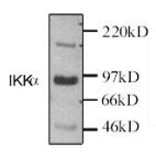 anti-conserved Helix-Loop-Helix Ubiquitous Kinase (CHUK) antibody avatar