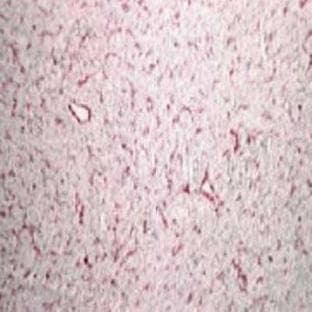 anti-Actin, alpha 2, Smooth Muscle, Aorta (ACTA2) (N-Term) antibody avatar