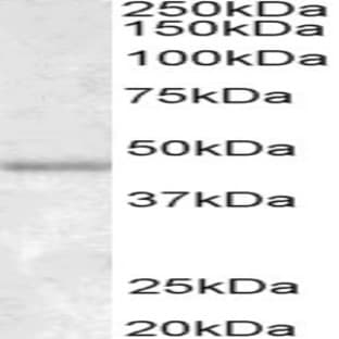 anti-Actin, alpha 2, Smooth Muscle, Aorta (ACTA2) (N-Term) antibody avatar