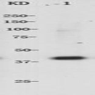 anti-Actin, alpha 2, Smooth Muscle, Aorta (ACTA2) antibody avatar
