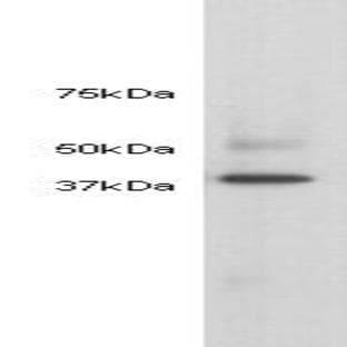 anti-Actin, alpha 2, Smooth Muscle, Aorta (ACTA2) antibody avatar