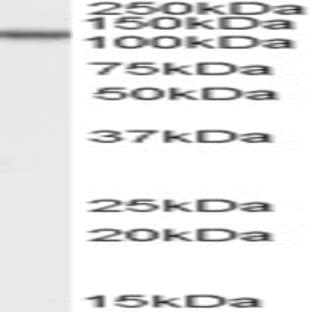 anti-Oxysterol Binding Protein-Like 5 (OSBPL5) (N-Term) antibody avatar